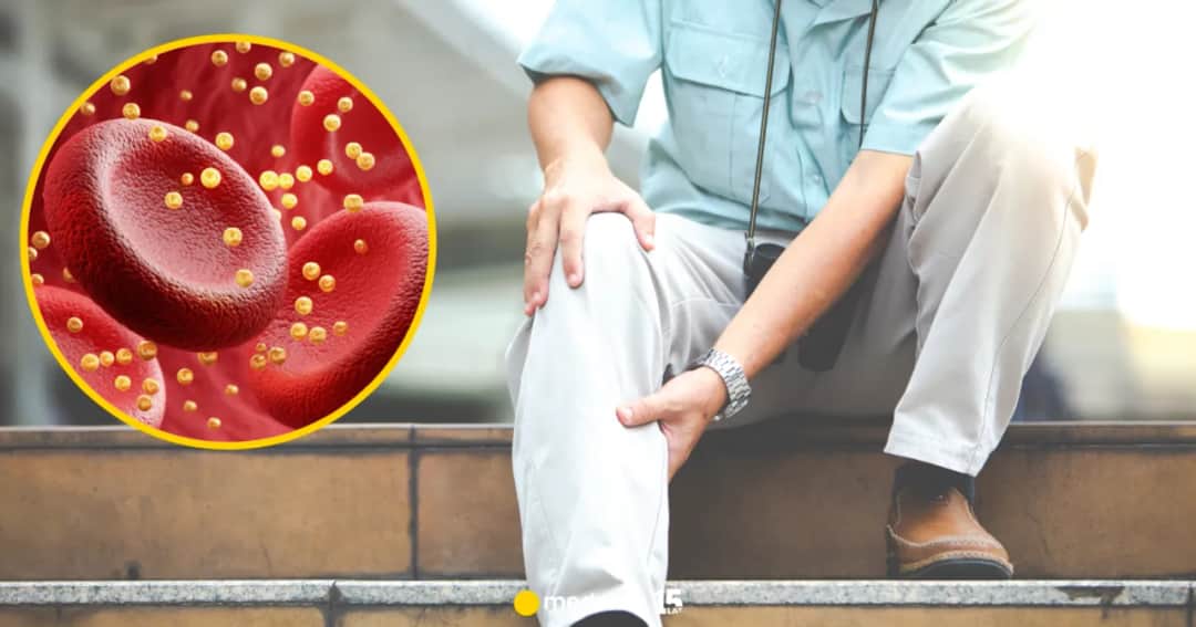 Wysoki cholesterol: Cichy zabójca. Poznaj skutki dla zdrowia!